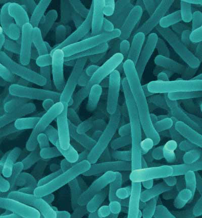 Listeriosis là do vi khuẩn listeria monocytogenes, một loại vi khuẩn tìm thấy trong đất và nước