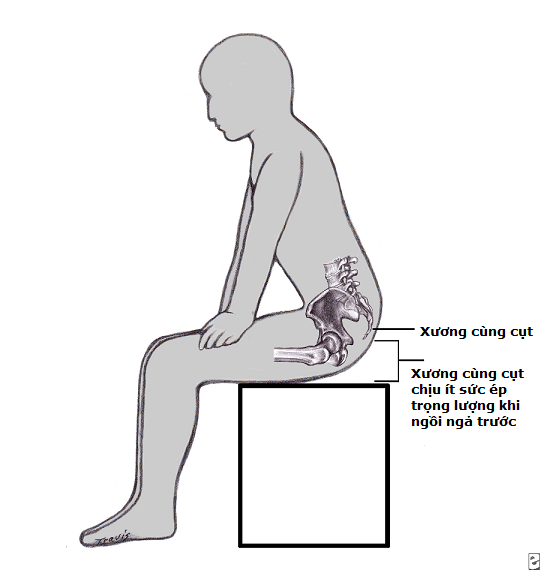 Khi bị đau xương cụt, người bệnh sẽ gặp khó khăn khi ngồi xuống, đứng lên