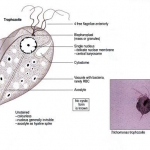 Trichomonas là tên gọi một loại trùng roi có hại, kí sinh ở vùng kín của phụ nữ nếu mắc bệnh