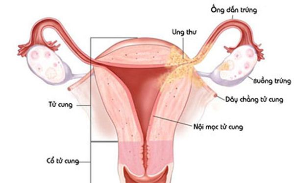Giải phẫu cổ tử cung ở phụ nữ