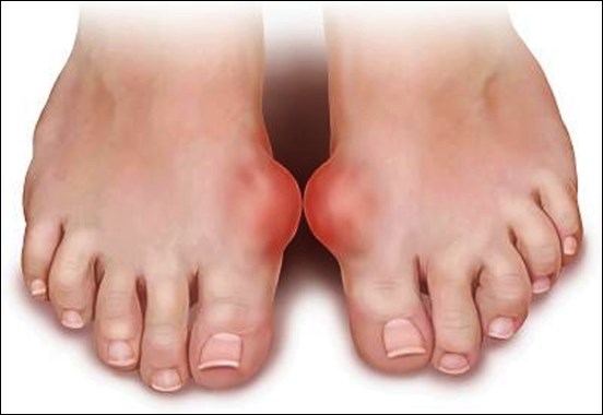 Ngón chân dày liên quan đến bệnh phổi