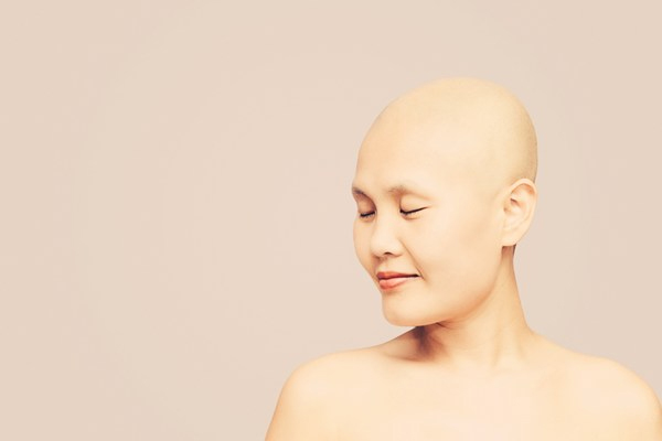Phụ nữ điều trị ung thư vú rất cần được quan tâm