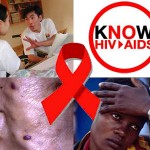 hiv-aids-12