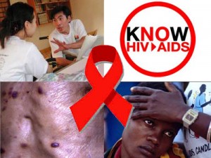 hiv-aids-12
